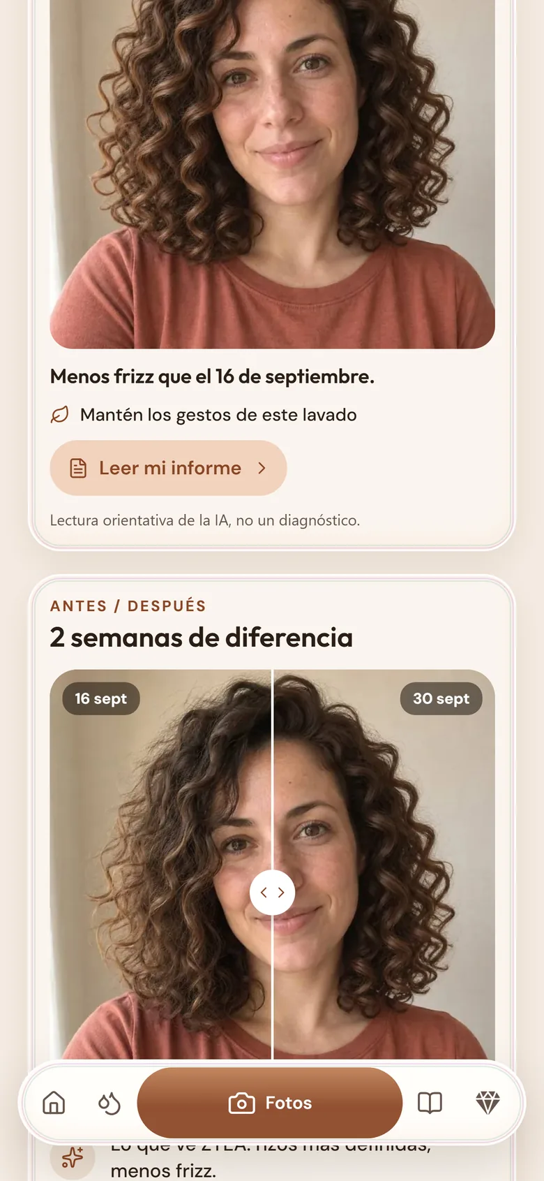 La pantalla Fotos: la foto del mes, el botón Leer mi informe y dos fotos comparadas con dos semanas de diferencia.