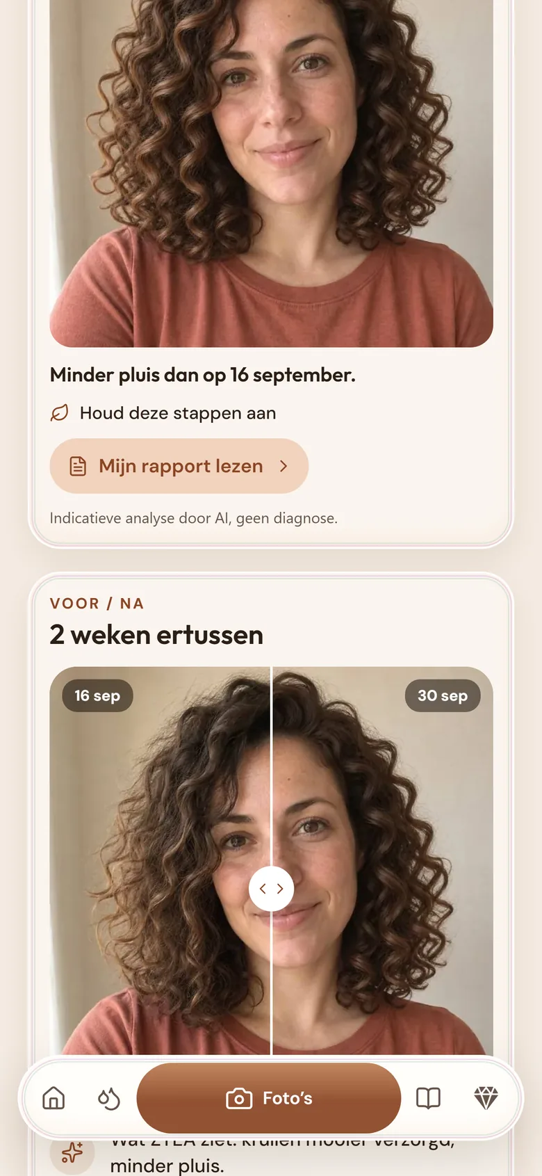 Scherm Mijn foto’s: de foto van deze maand, de knop Mijn rapport bekijken en twee foto’s met twee weken ertussen.